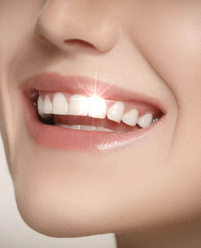 Teeth Whitening